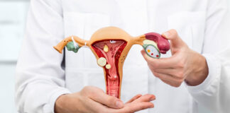 Março amarelo: Endometriose acomete uma em cada dez mulheres e pode levar à infertilidade