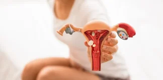 Endometriose mau tratada pode dificultar gravidez