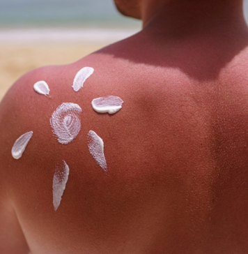 #NoSunscreen: movimento viral entre jovens preocupa especialistas