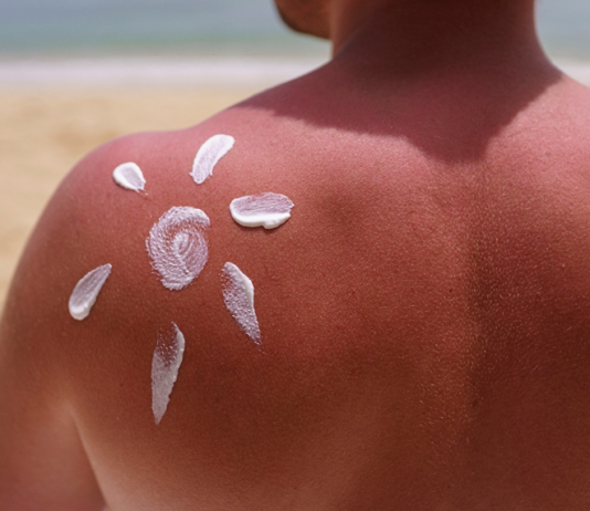 #NoSunscreen: movimento viral entre jovens preocupa especialistas