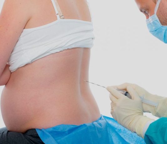 Mitos e verdades sobre anestesia no parto