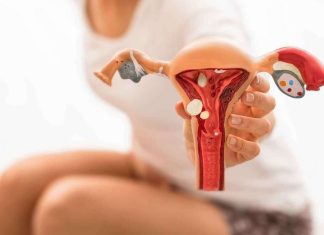 O que está por trás da Síndrome dos Ovários Policísticos?