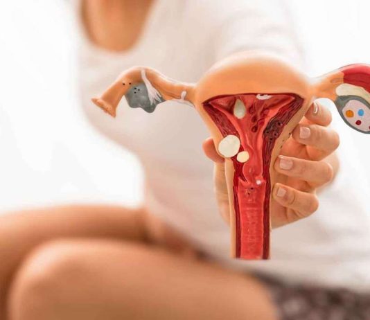 O que está por trás da Síndrome dos Ovários Policísticos?