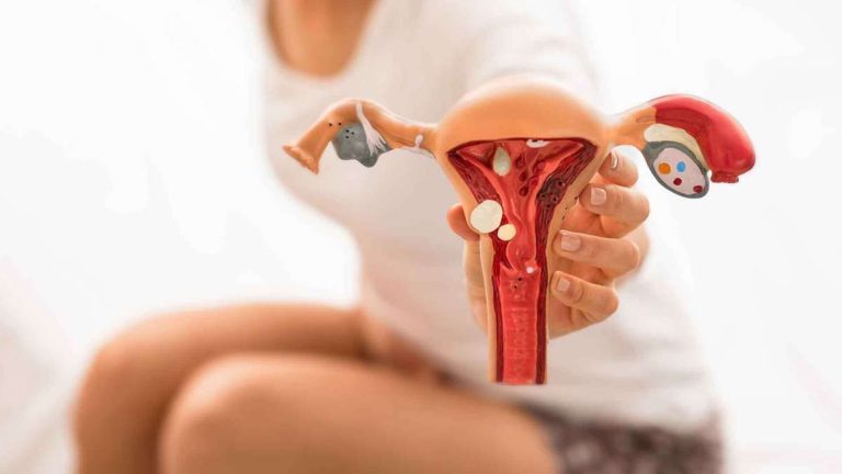 O que está por trás da Síndrome dos Ovários Policísticos?