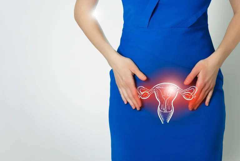 Endometriose, intolerância alimentar ou SII? Saiba como diferenciar os sintomas